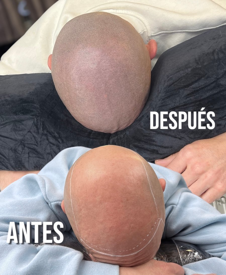 ¿En qué consiste?