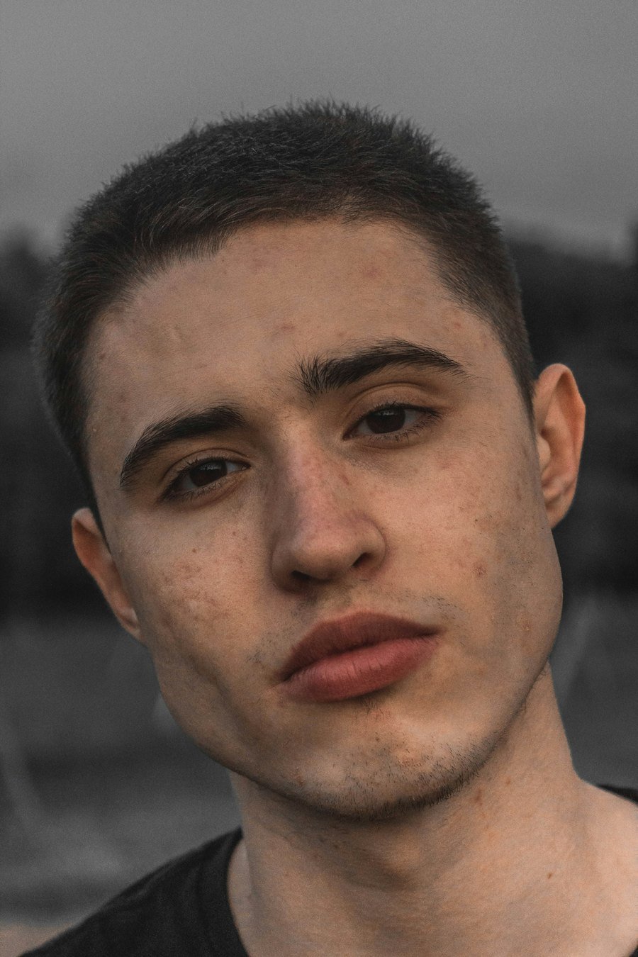 Solc nasogenià