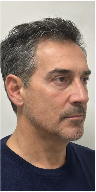 Hilos tensores, después