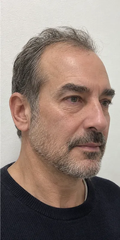 Hilos tensores, después
