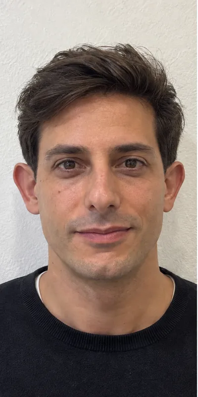 Otoplastia, antes